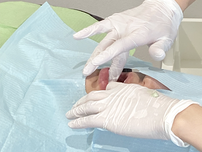 歯茎のマッサージ