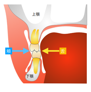 こどもの歯科矯正